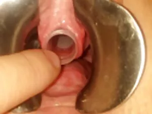 Sexo simple de una c ...